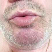 ���������� �����������, ���� ������� ����, 63 ����, ������������ ��� ������