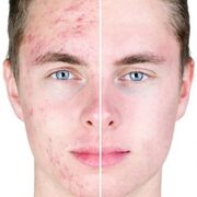 ���������� �������, ���� ������� ������, 37 ���, ������������ ��� ������, ����� � ���������