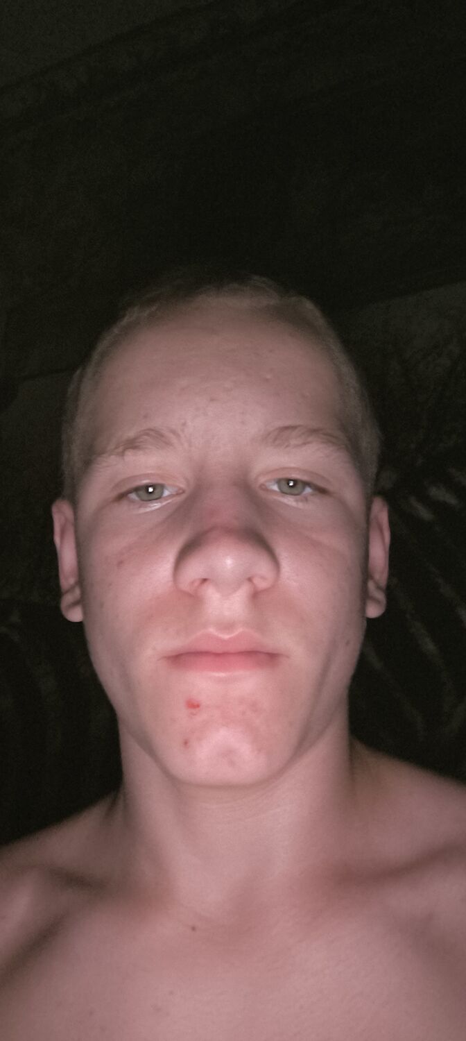  Homberg,   , 18 ,   ,   