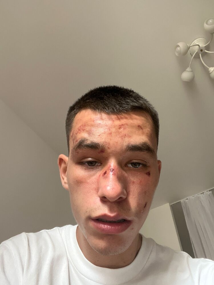 ���� 37556717 ����� ������, 24 ����, ���� ���������� � ������