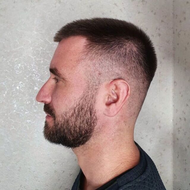  33021287  , 36 ,    