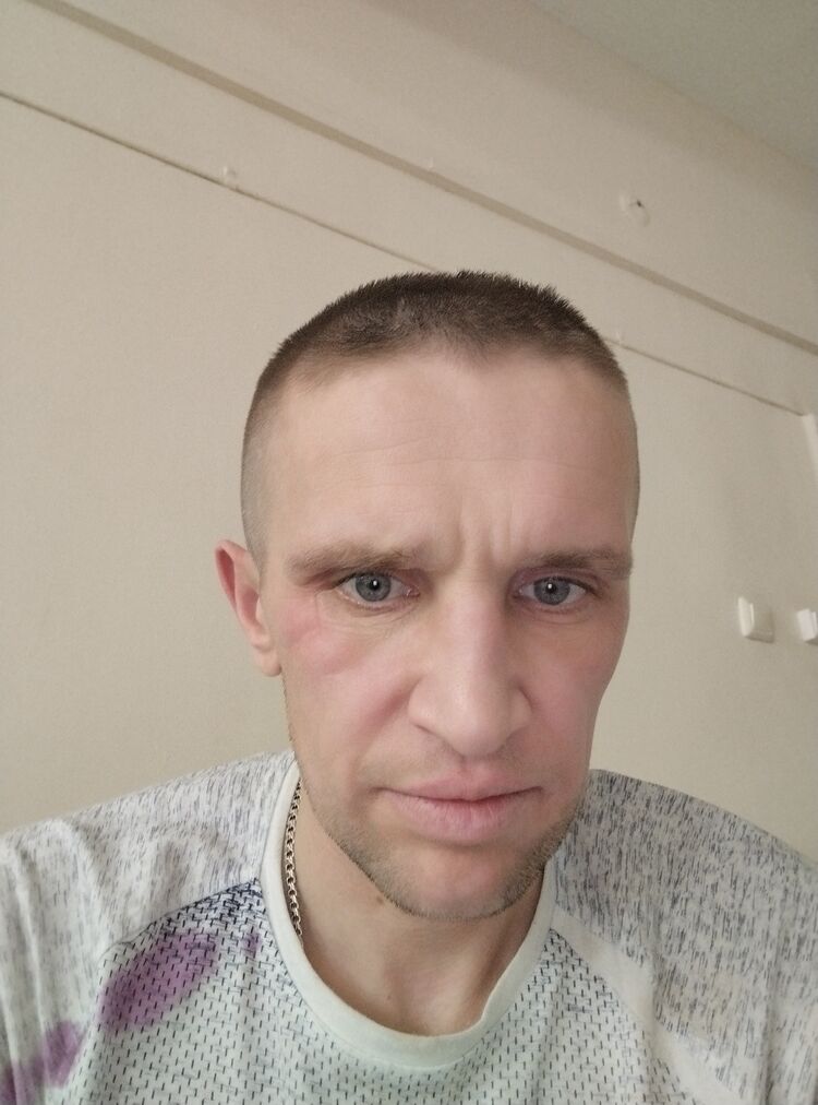  42644537  , 38 ,    