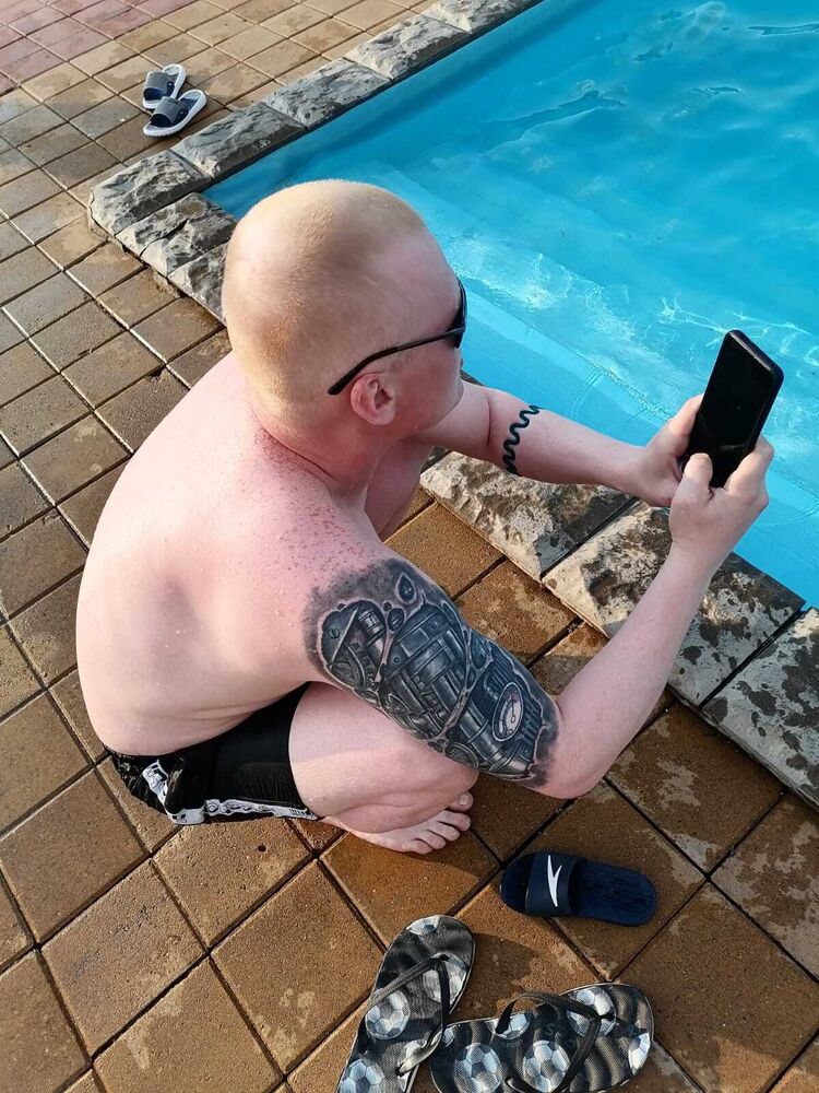  28828777  , 38 ,    