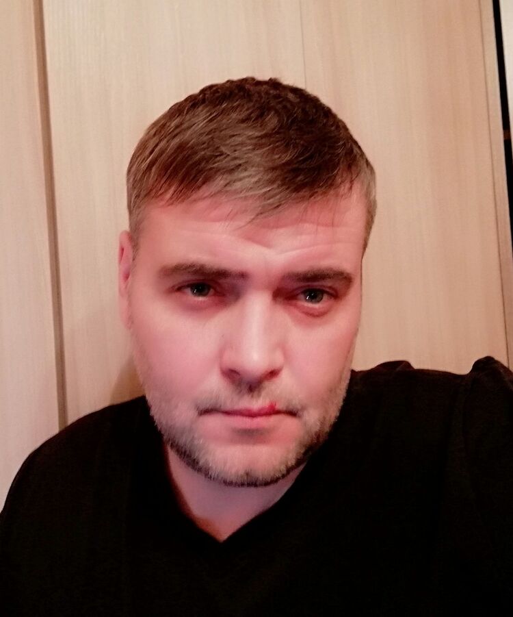  15043217  , 40 ,    