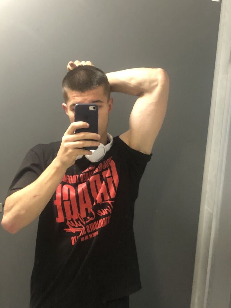  35540847  , 20 ,    