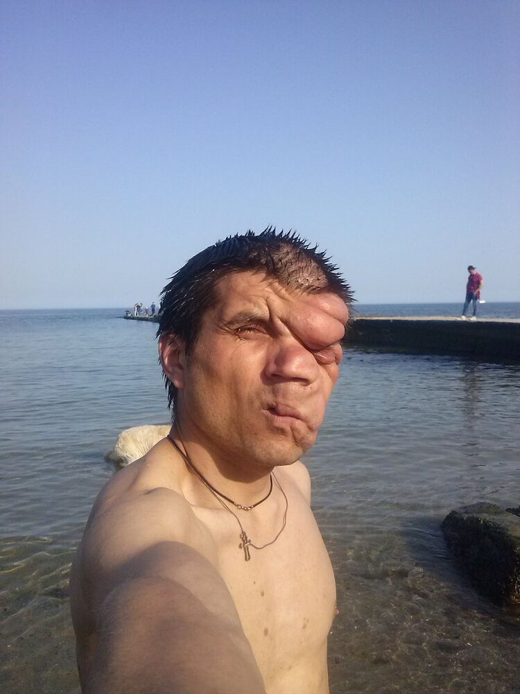  14865387  , 33 ,    