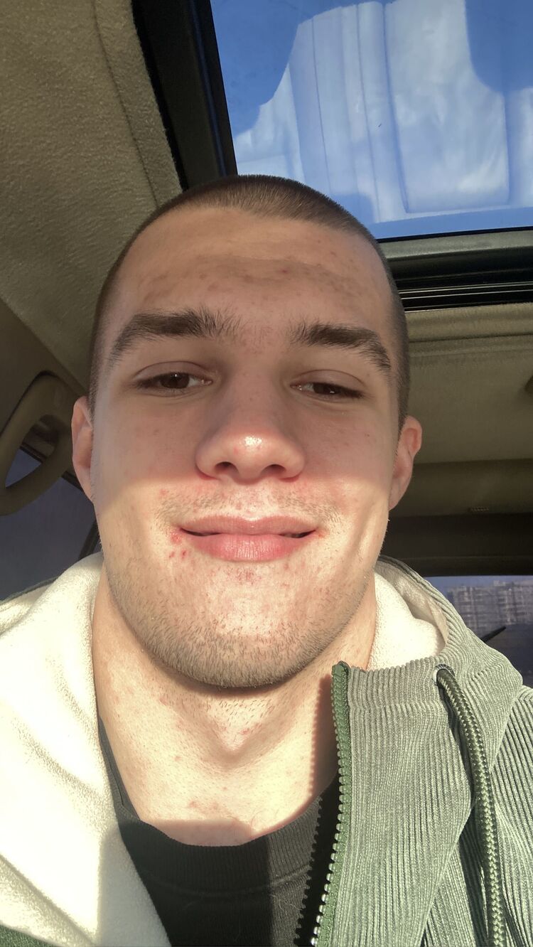  31504147  , 24 ,    