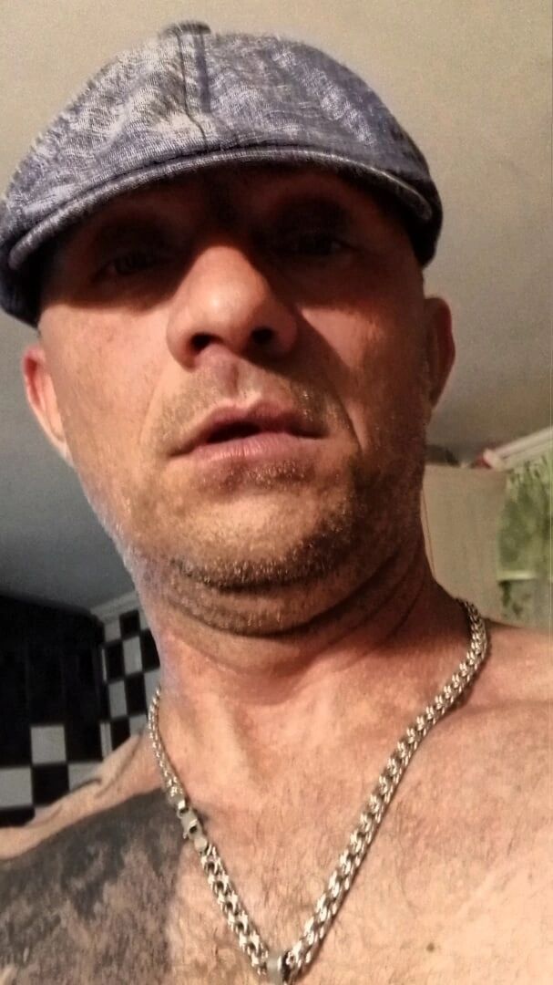  43581647  , 45 ,    