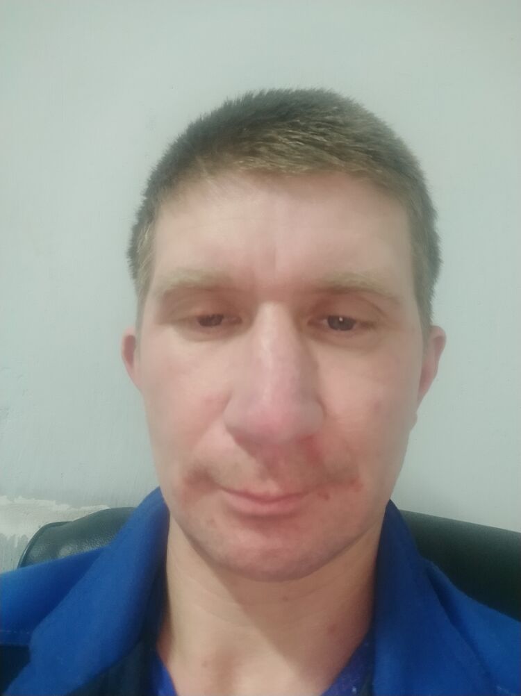  31998787  Anton, 43 ,    