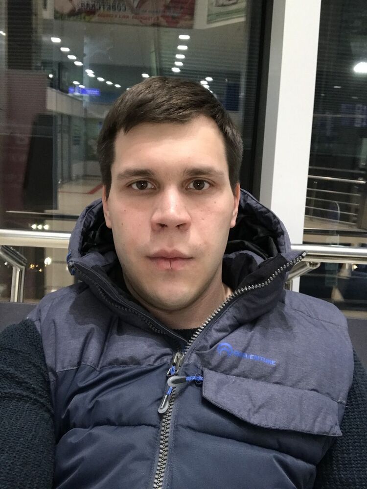  10479737  , 33 ,    