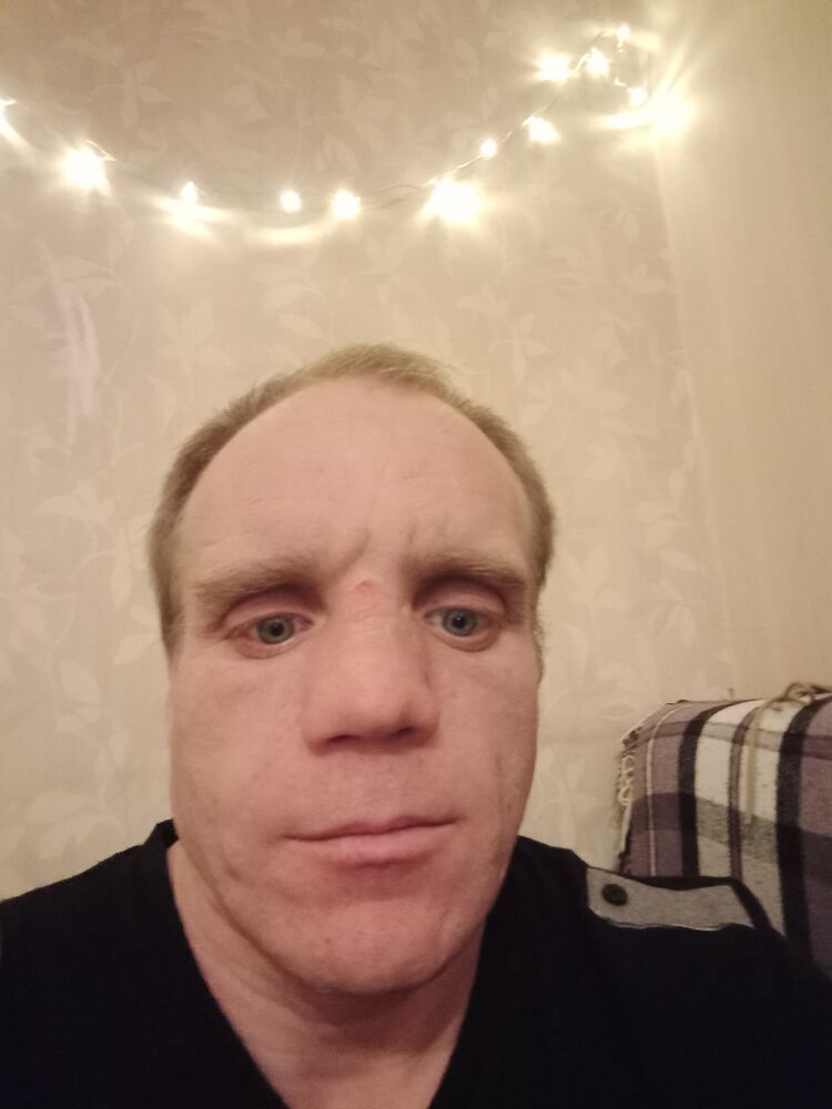  48855037  , 45 ,    