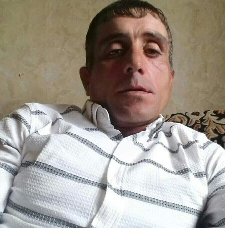  46629927  , 43 ,    