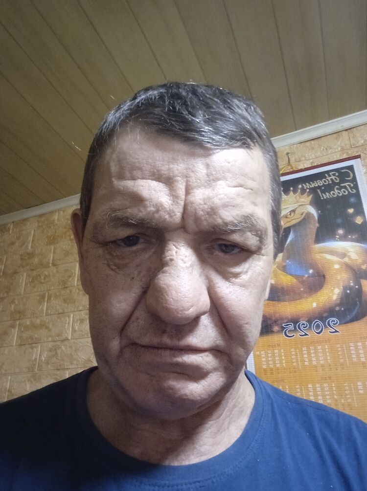  47777697  , 54 ,    