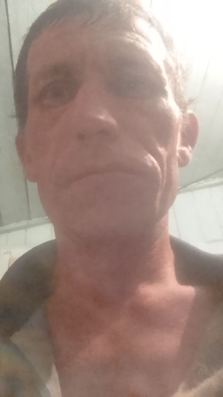  44227957  , 42 ,    