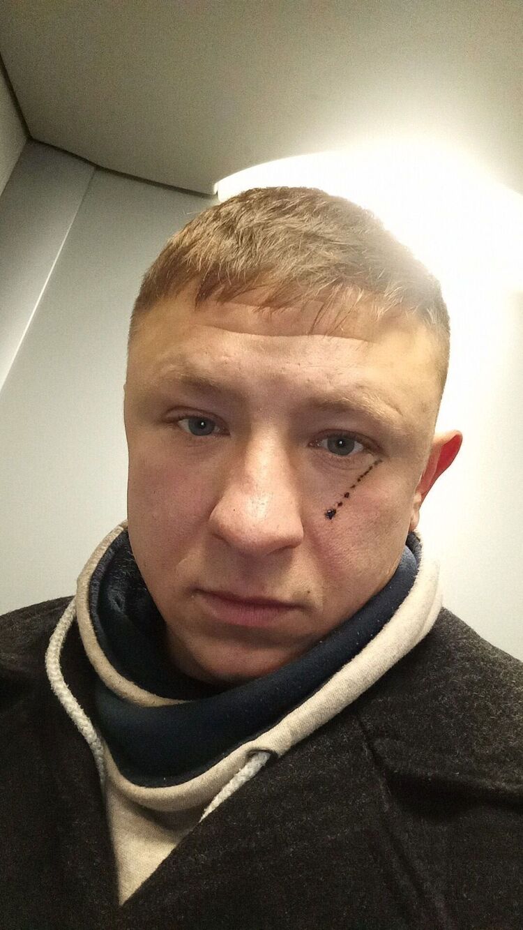 ���������� �����������, ���� ������� ������, 35 ���, ������������ ��� ������, ����� � ���������