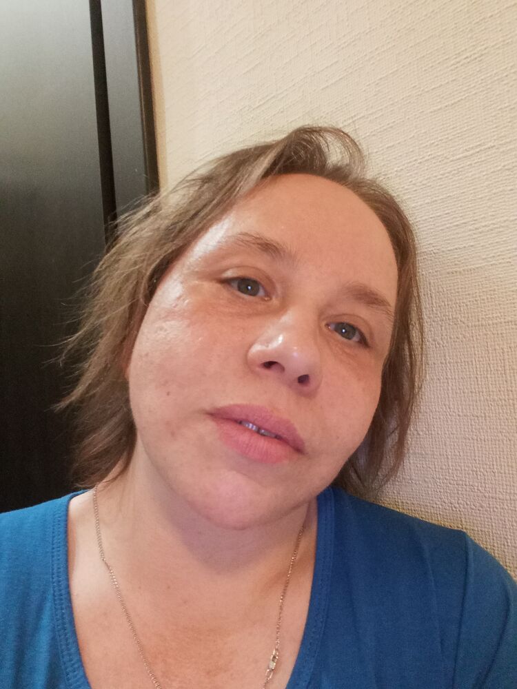  38283677  , 49 ,    -