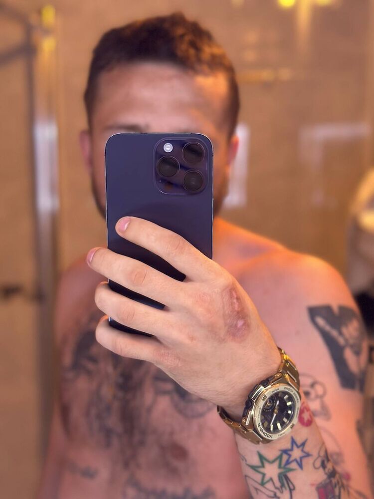  37901897  , 25 ,    