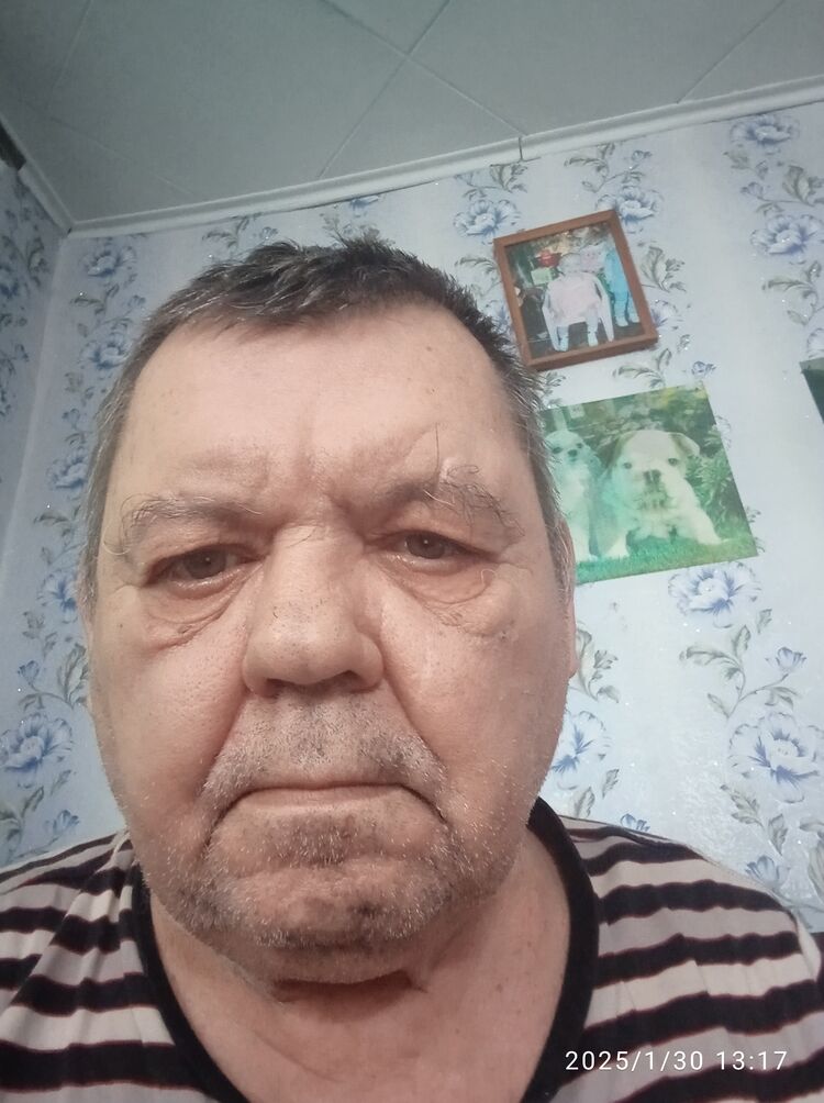  49314937  , 65 ,    