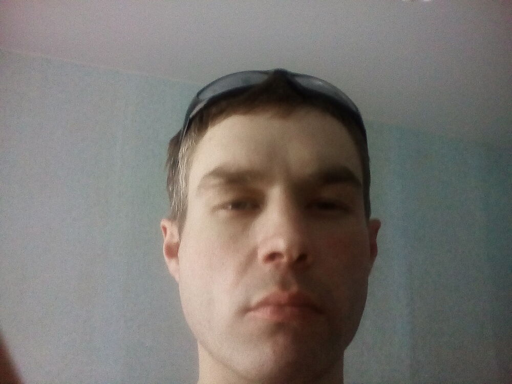  15044177  , 35 ,    