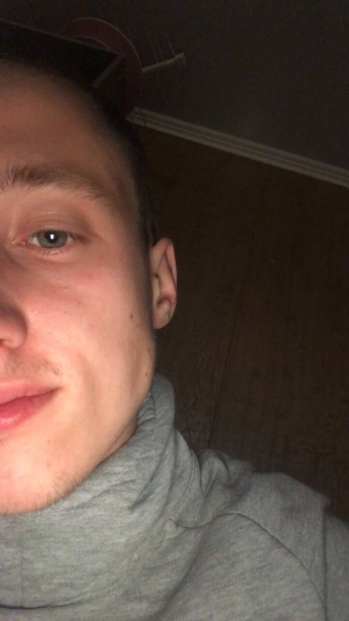  28965377  , 33 ,    