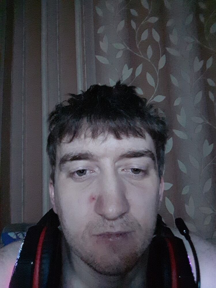  18943177  , 35 ,    