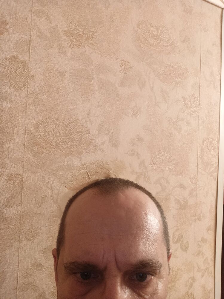  26015677  , 55 ,    