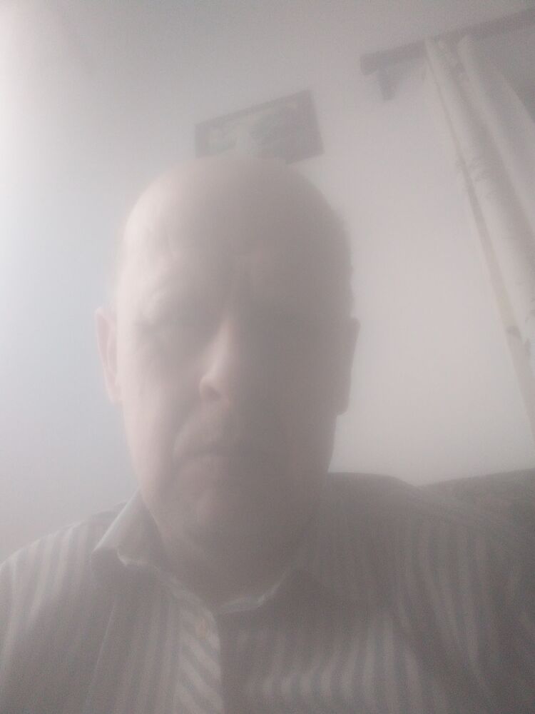  49662547  , 55 ,    