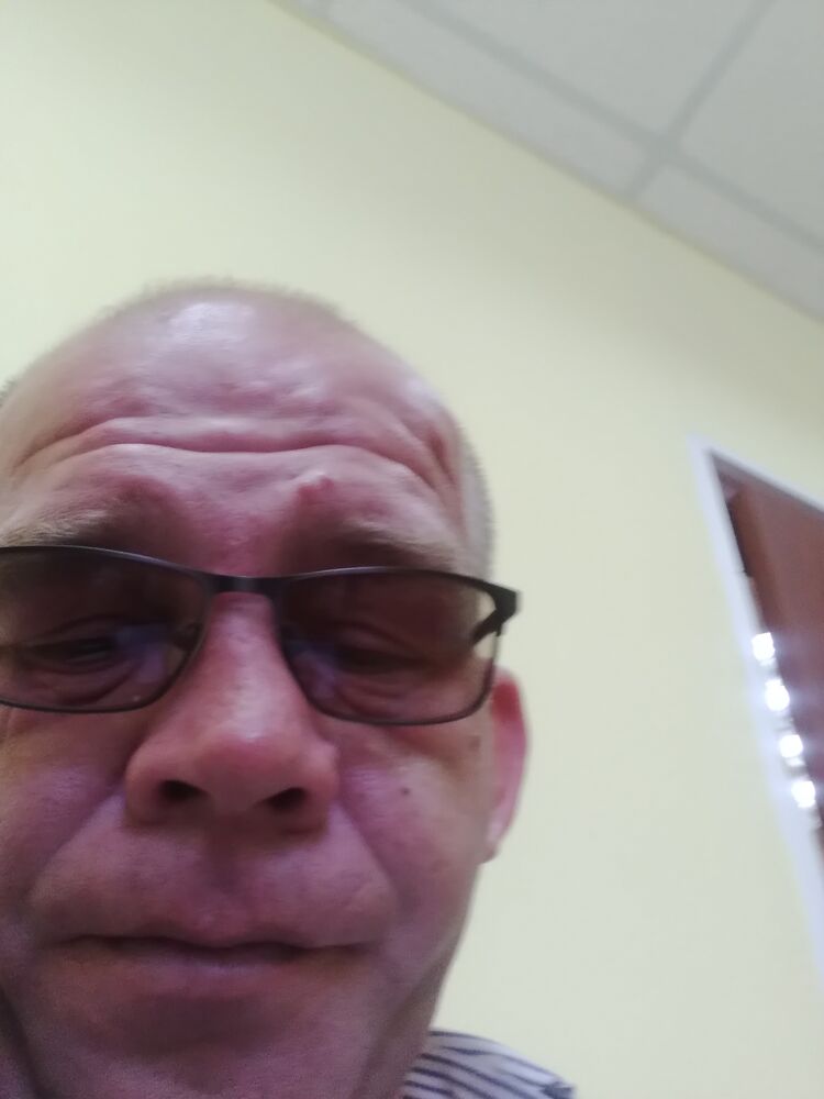  33297327  , 38 ,    