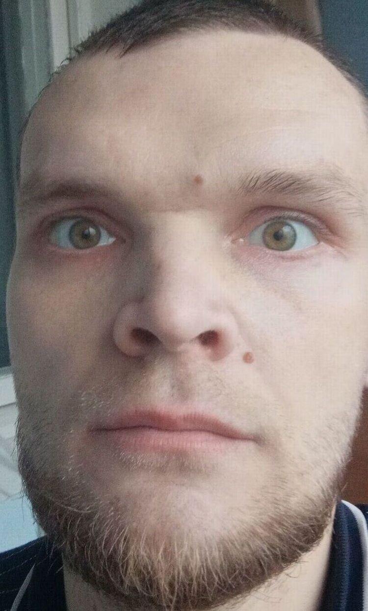 ���������� ����, ���� ������� ������, 35 ���, ������������ ��� ������, ����� � ���������