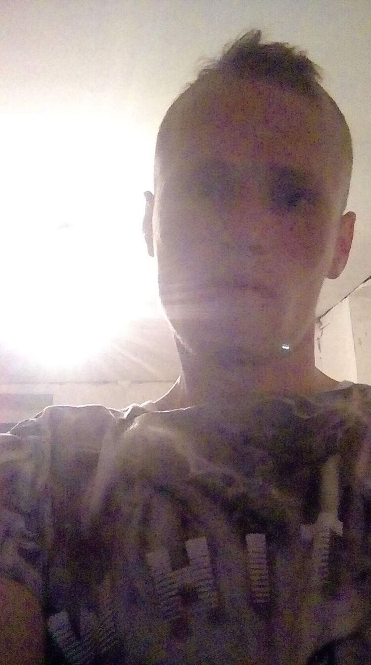  29374507  , 33 ,    -