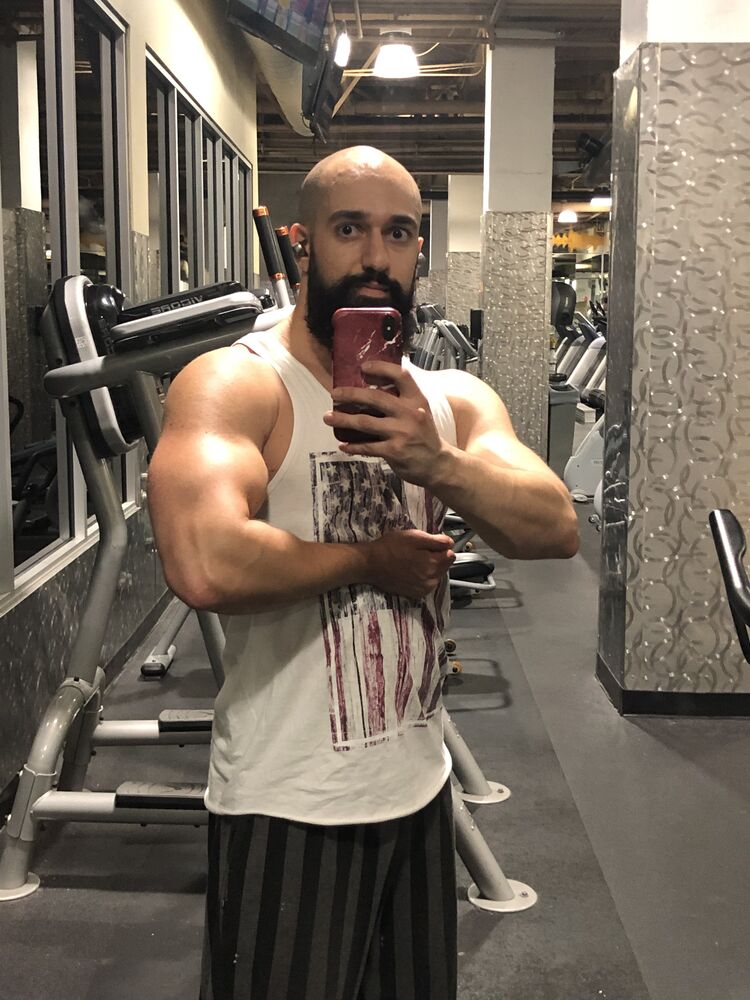  34928897  , 28 ,    
