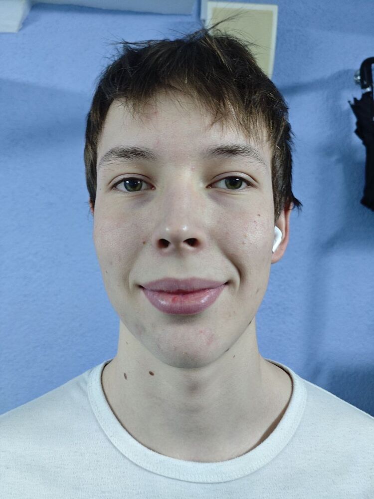  ,   Hijgp, 22 ,   ,   