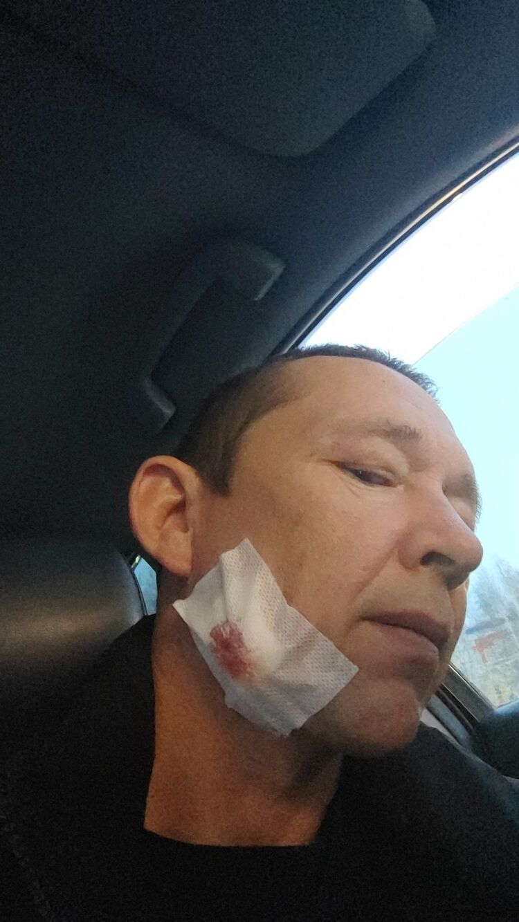  49773737  , 57 ,    -