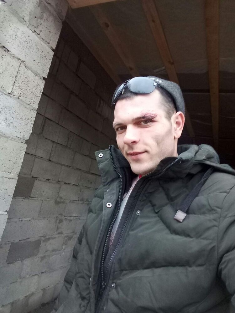 ���������� ������-��-����, ���� ������� �������, 28 ���, ������������ ��� c�������� ���������