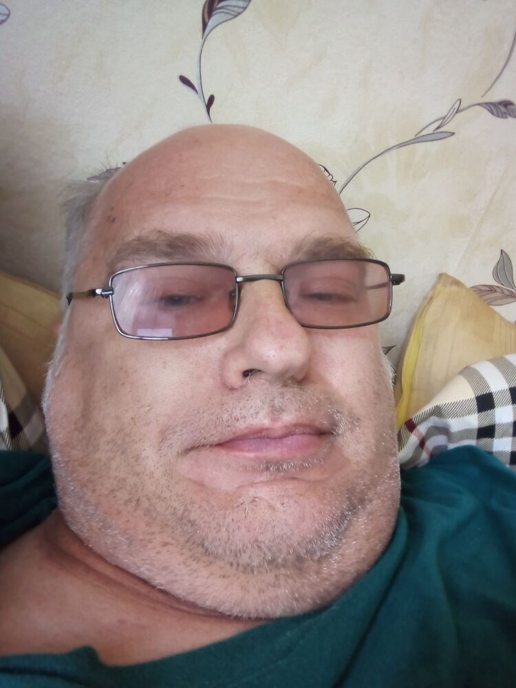  35662307  , 49 ,    
