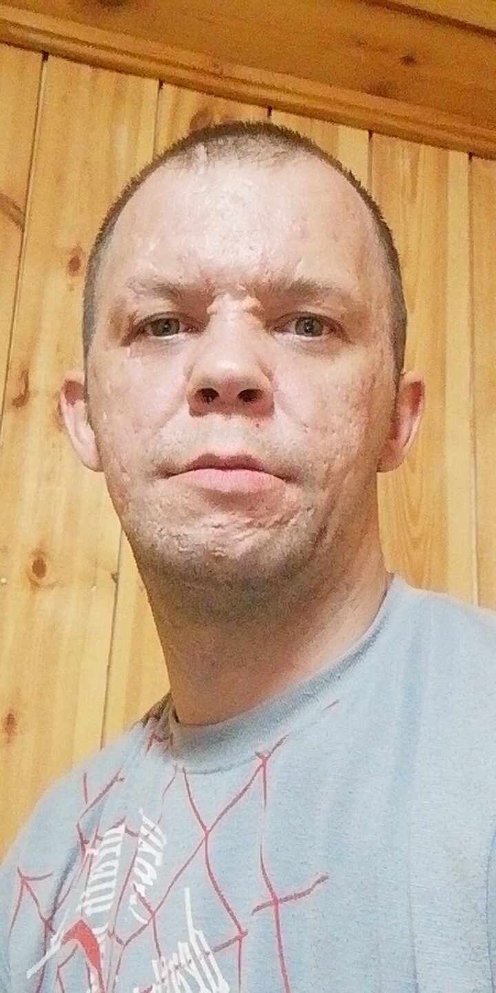  23838637  , 34 ,    