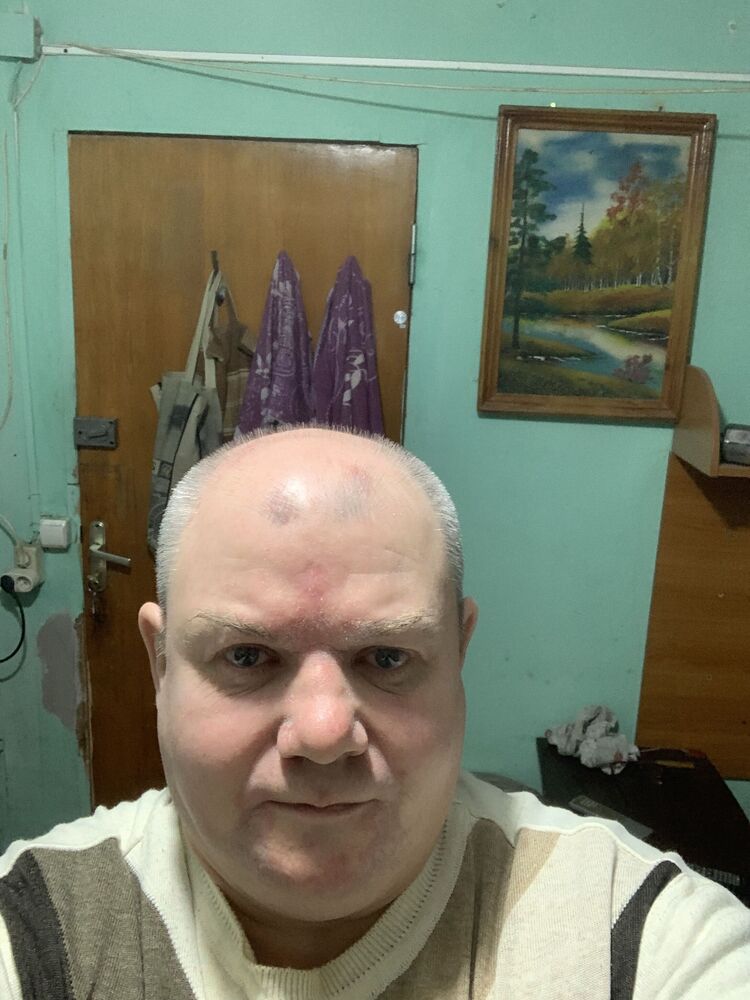  48228557  , 55 ,    