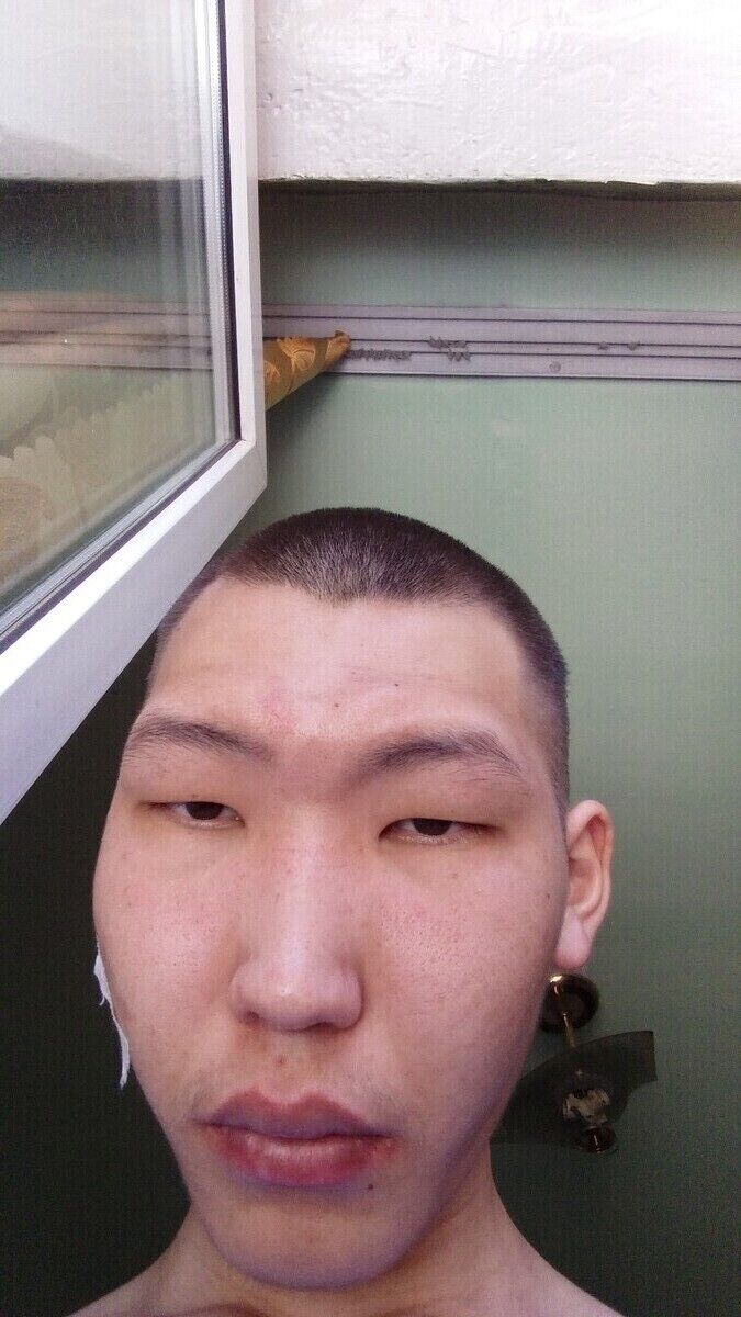  19953647  , 25 ,    