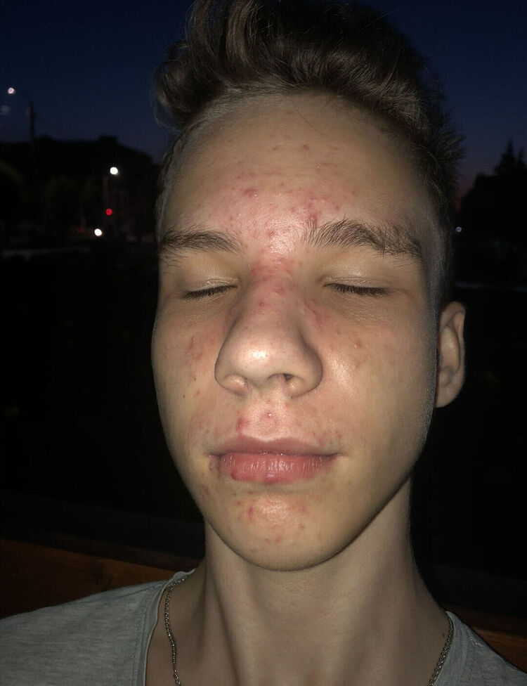  42931707  , 21 ,     