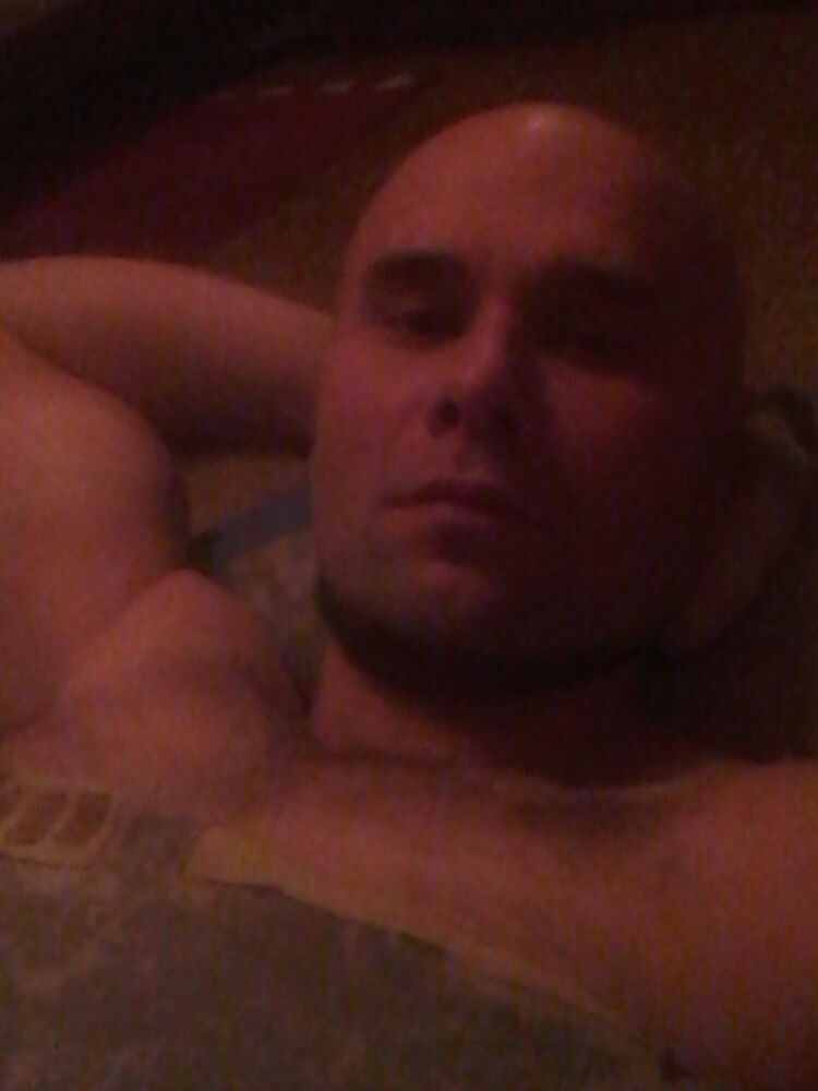  17715987  , 35 ,    