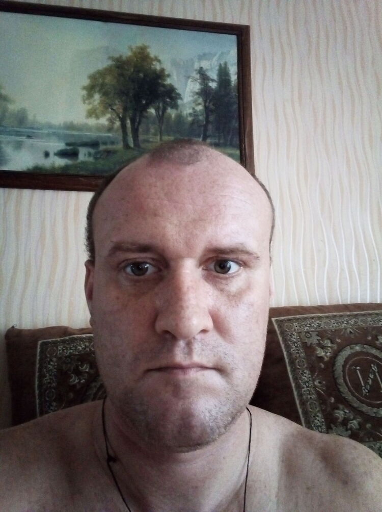  16027887  , 41 ,    --