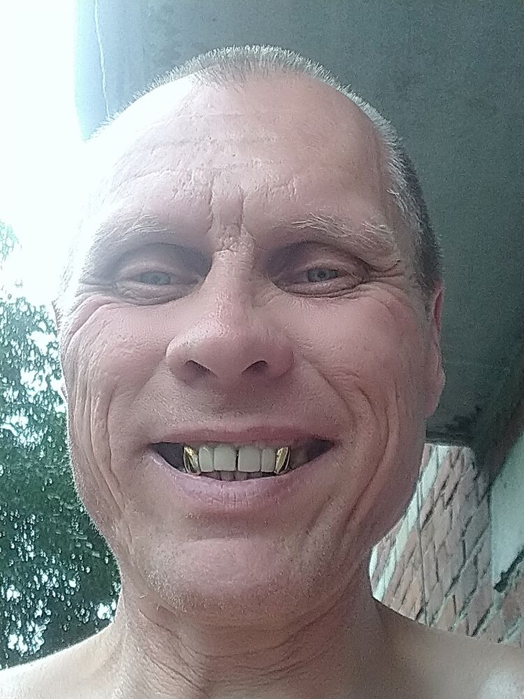  45444307  , 48 ,    