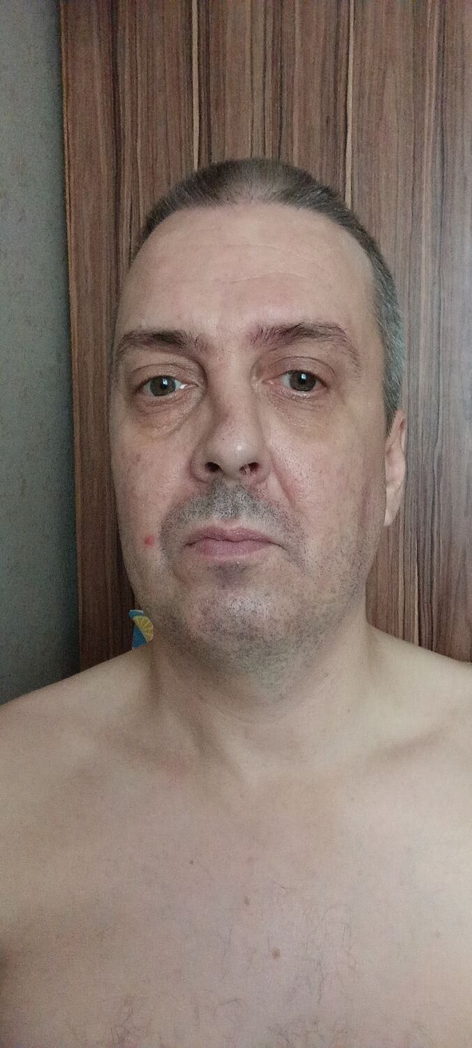 36617557  , 47 ,    